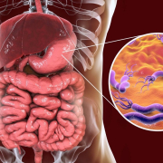 Dangers of foodborne illness